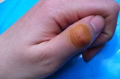 老鼠为什么会咬人睡着不被它咬