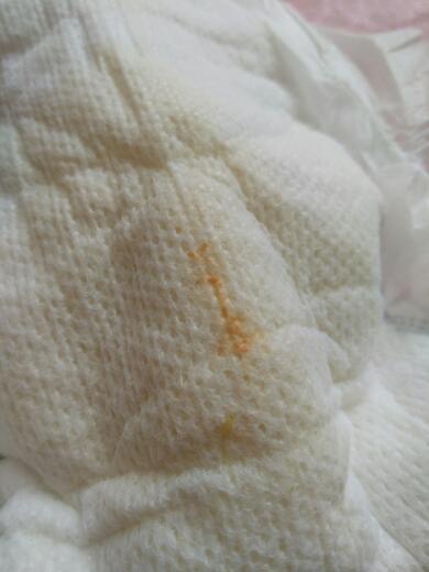 4月女宝宝尿液带有橙色分泌物