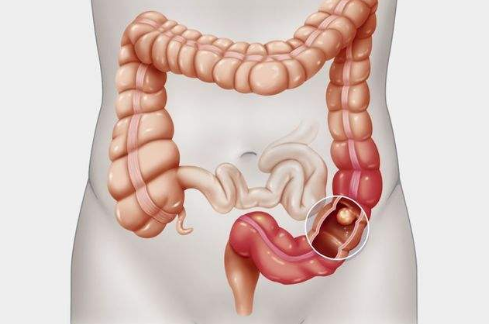 与横结肠相通的结构是什么?