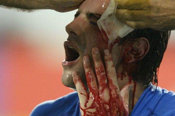 受伤后,舔舐伤口真能促使伤口愈合吗?