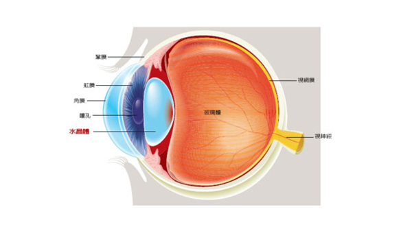 治疗白内障的有效手段是什么?