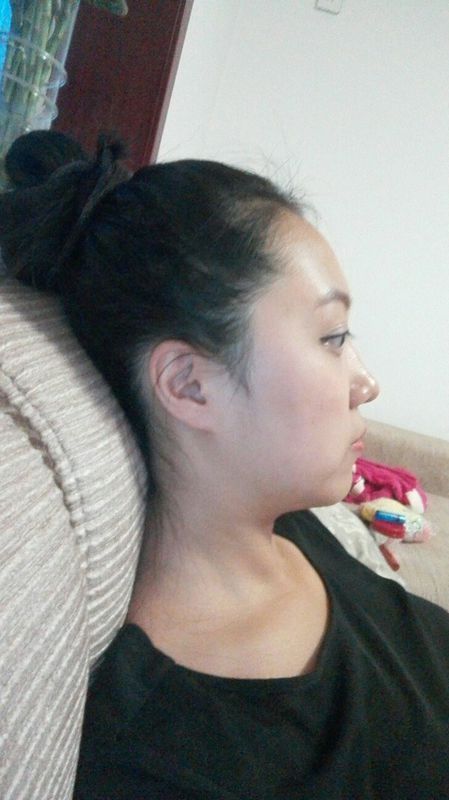 脸胖的原因是什么,水肿?肌肉太大?还是松弛下