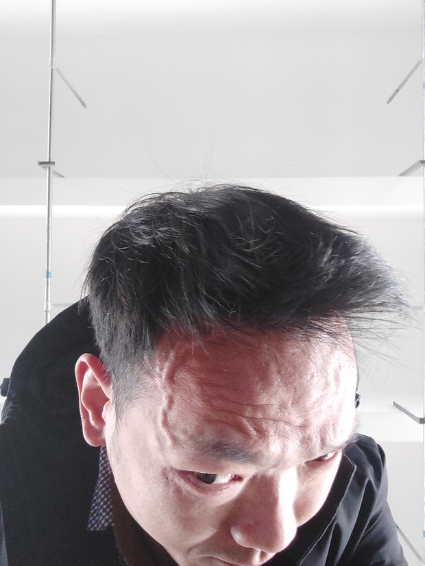 弯腰低头大脑充血额头血管暴起