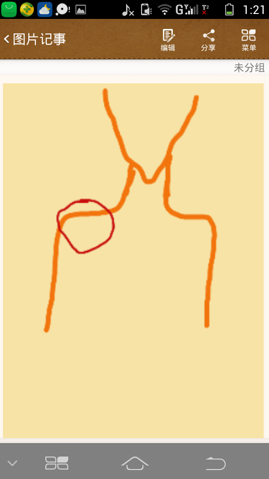 右边锁骨下方靠近腋下的位置有点痛,会牵连到整个右手发不出力气,不是