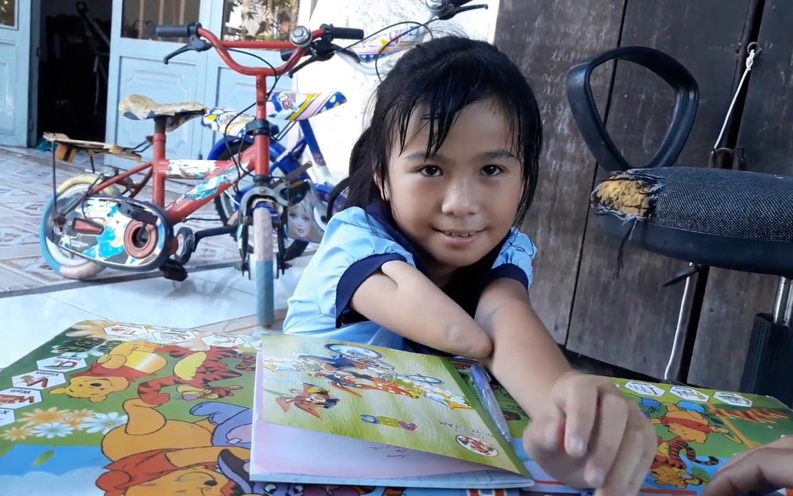 害羞漂亮的残疾小女孩amm柳塞巴一边手脚畸形,一个叫开悟的家庭