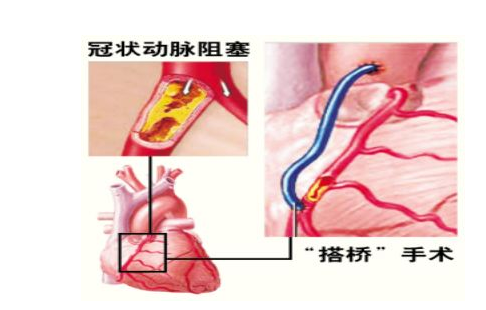 心胸医院的发展动态：以上海为例