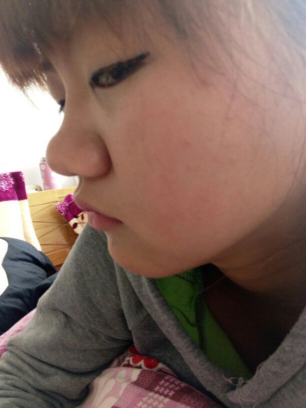 这样的鼻子算什么类型的鼻子,长的好难看,眼还