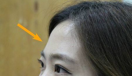 为什么有的人额头的皮肤比脸的更黑