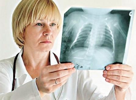 肺癌病人可以吃蜂王浆吗