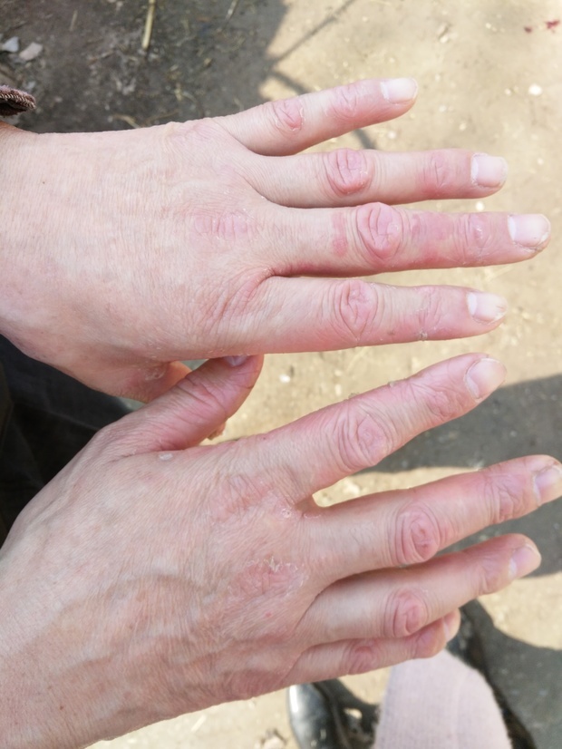 南京皮肤研究所在哪里?什么皮肤病都可以看吗