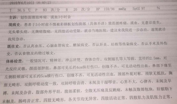 谁能帮忙列一份2015年河南省九级工伤伤残赔