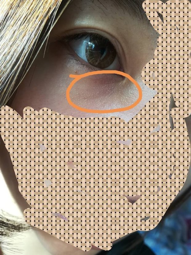 有没有懂护肤的妹子 眼睛下面这一圈小小的是什么啊闭口还是脂肪粒