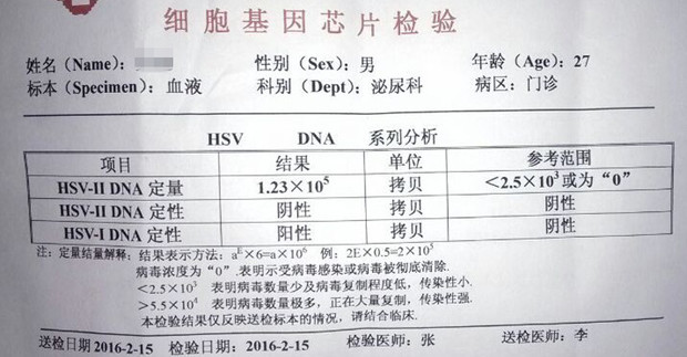 单子是什么意思图片