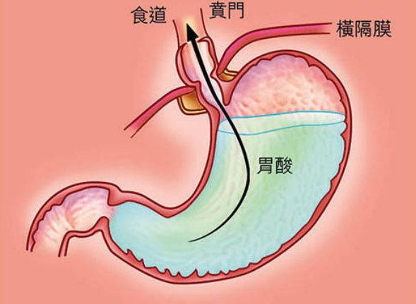 正常胃液颜色的图片图片