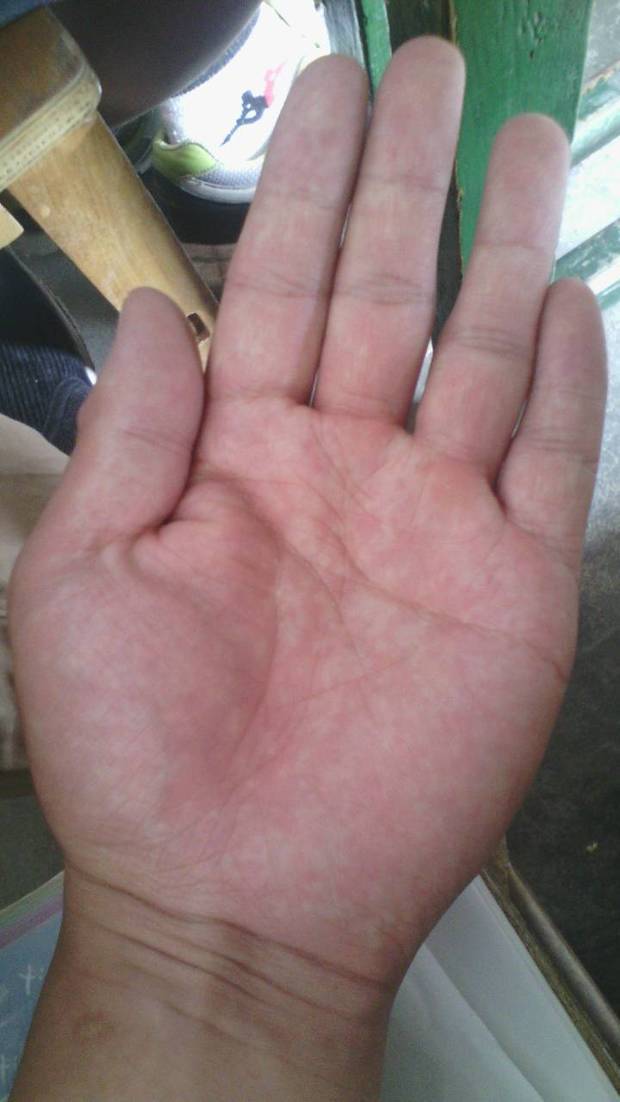 为什么我的手掌很厚,而且比手指长,手指短