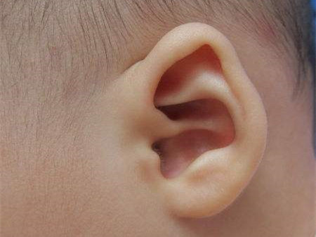 婴儿正常耳朵图片