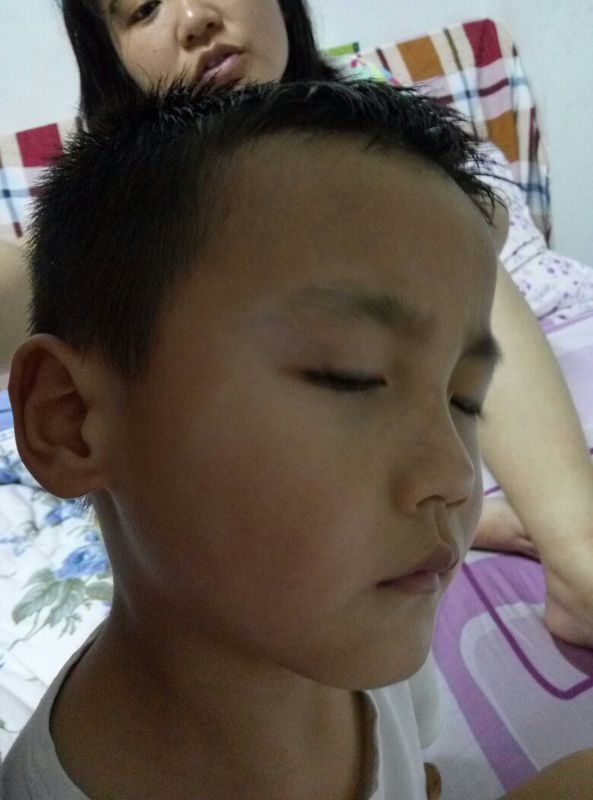 孩子四岁,这种状况可能有一两年了,黑一块白一块,麻烦帮忙