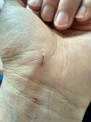 没有破皮没有事的 你不用担心啦 自己家里猫咪咬伤流血了也没事的 我