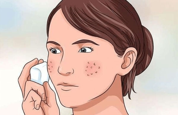 如何快速消除痘印?