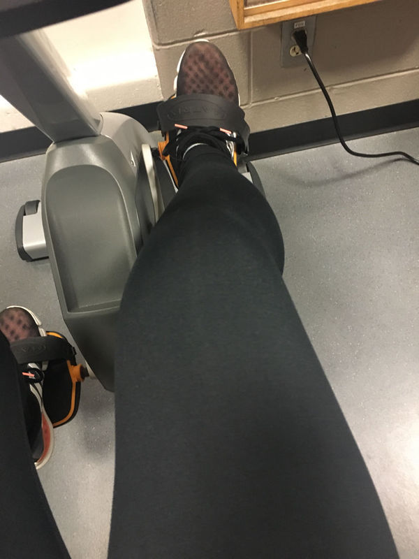 如图我这种小腿肚往外翻着长的怎么减掉?