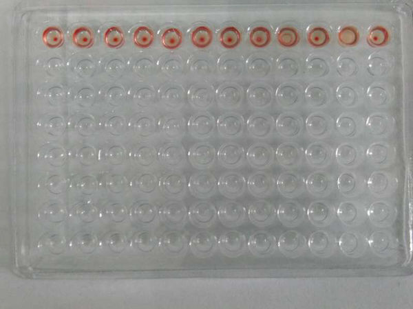 血凝试验还有血凝抑制试验怎么判断结果,以这