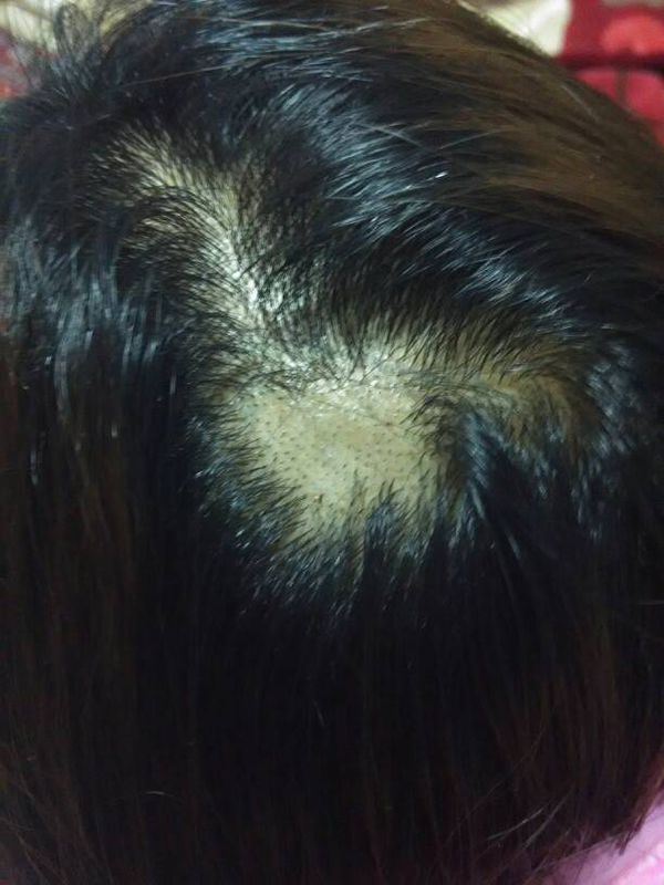 三个月前烫了发,今天又去软化拉直。拉直后被