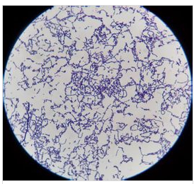 无乳链球菌的临床意义