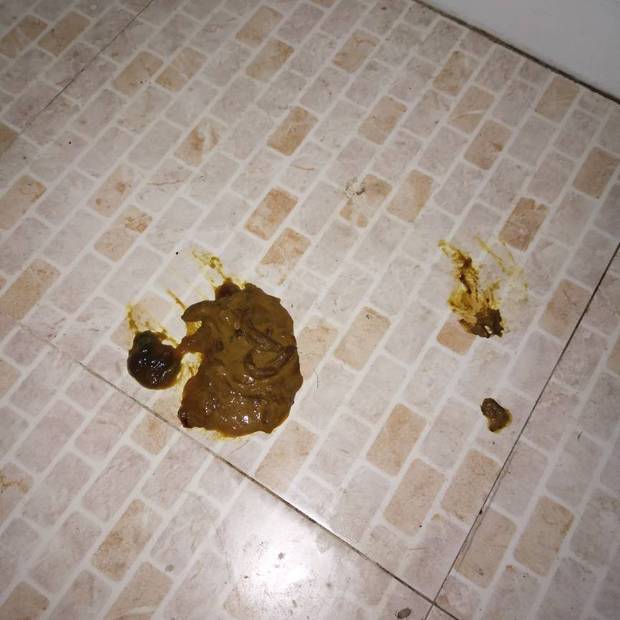 您好,给狗狗做了细小化验单,可是看不懂,有懂的人吗?