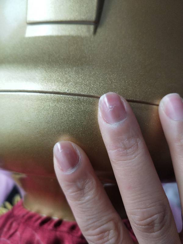 手指甲发灰竖纹是怎么回事?急急急