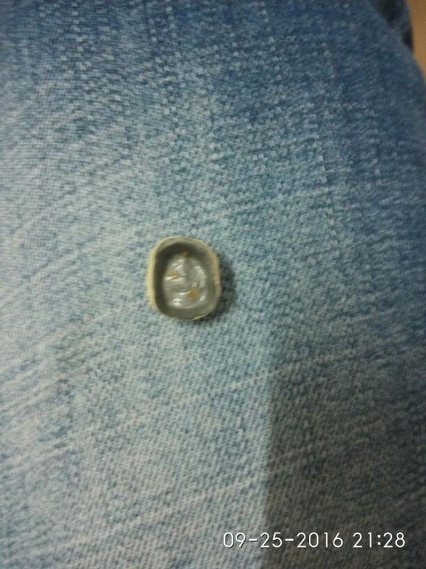 牙套1200价钱合理吗? 医生今天只给装牙套,还