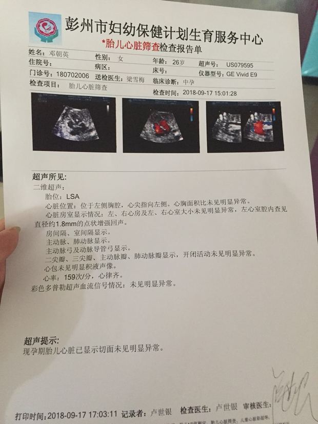 做四维左心室有强光点