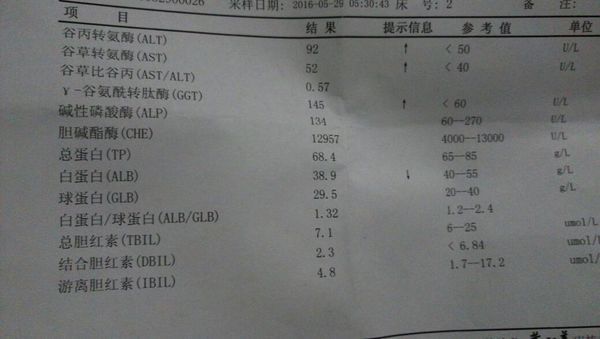 乙肝dna\检查小于5o0,转氨酶高是乙肝吗?男35