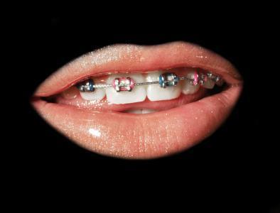 宝宝牙齿上有黑色素沉淀,愁死我了,该怎么办