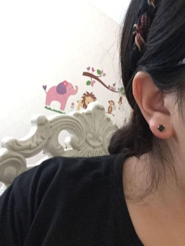 刚打完耳洞没保护好发炎了,第三天的时候我把