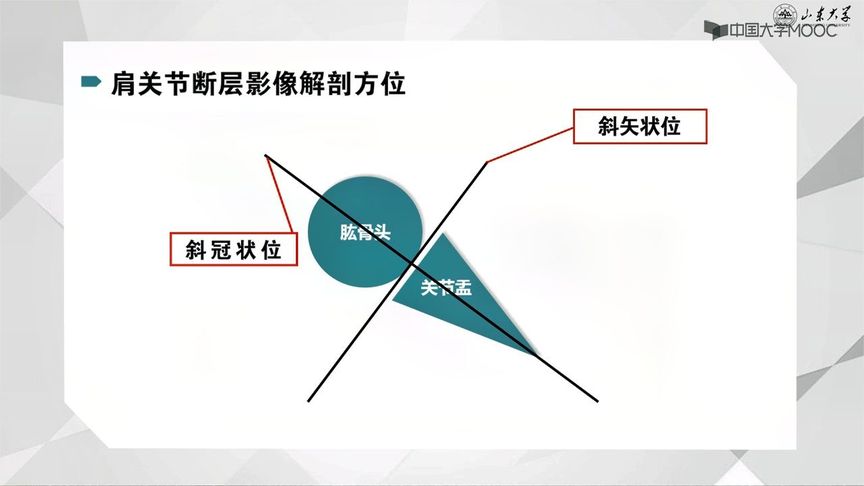 [图]断层影像解剖学--七、脊柱和四肢--7.4肩关节