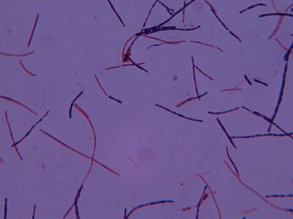 保加利亚乳杆菌的形态及染色