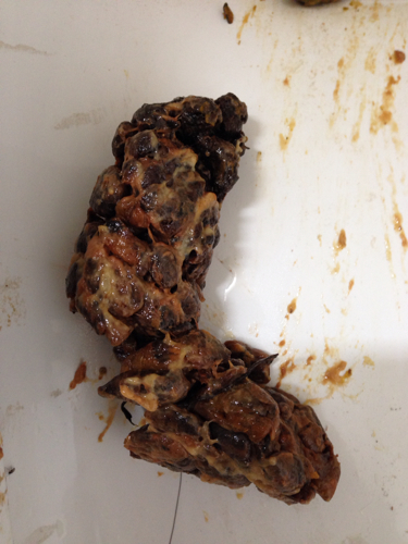 正在吃饭的千万不要进来,大便不成形是怎么回事呢