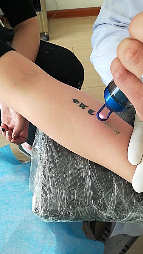 鞍山抚顺铁岭哈尔滨吉林本溪丹东朝阳盘锦专业洗纹身郑氏洗纹身视频