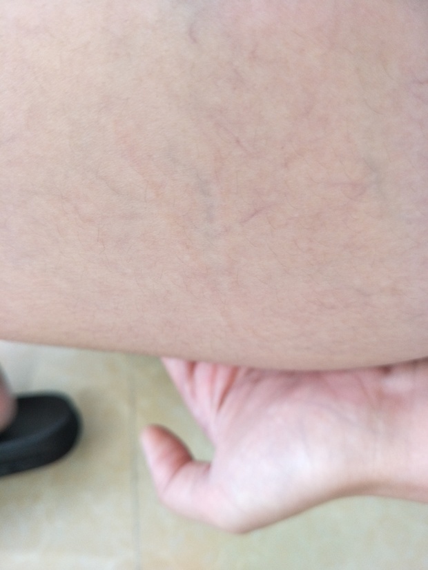 狗狗抓到了怎么办