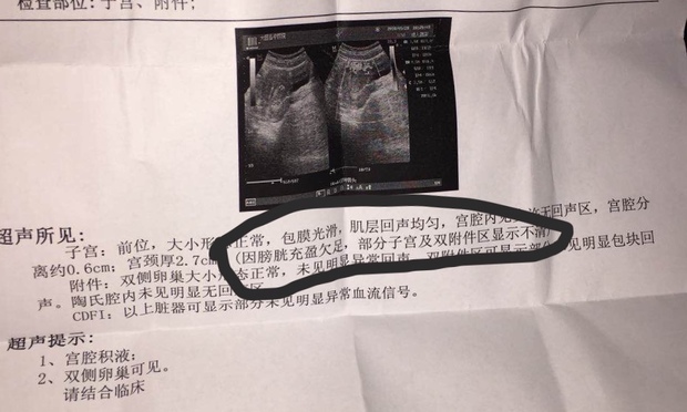 药流后清宫了再去做b超检查是否清干净