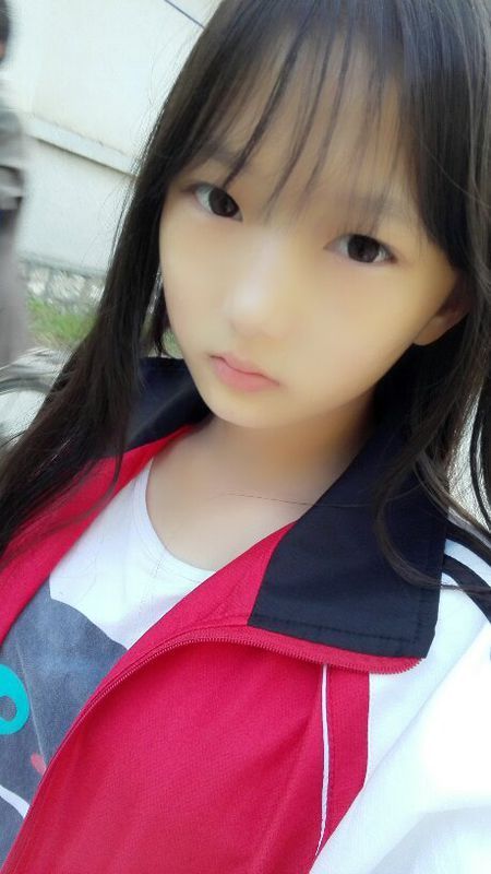 我才十四岁,,,脸上又有斑又有疤还有痘痘摸起来感觉坑坑挖挖的,,,有