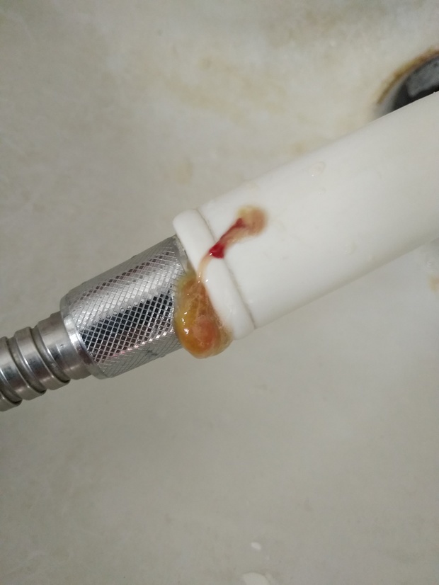 今天咔出来的痰,浓浓的,咔了半天,直接出来一块,好像还带血丝,跪问我