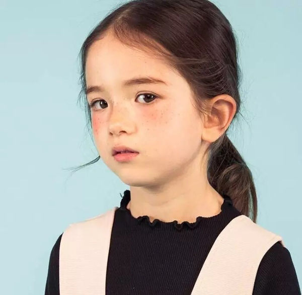 脸上有小雀斑的!