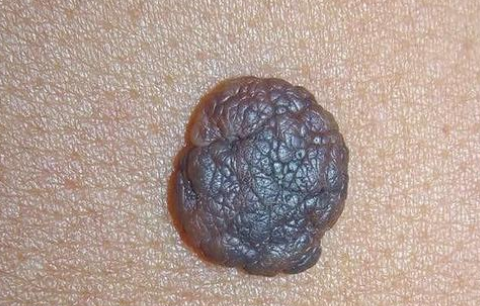 朱砂痣和白月光有什么区别?哪个更令人难割舍忘怀呢?