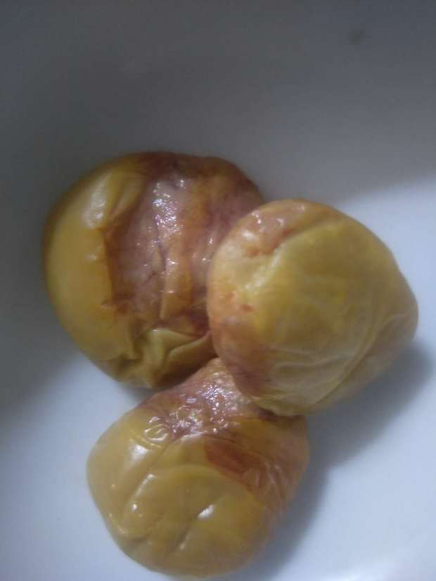 鸡肚子里有几坨黄色的多少是什么?