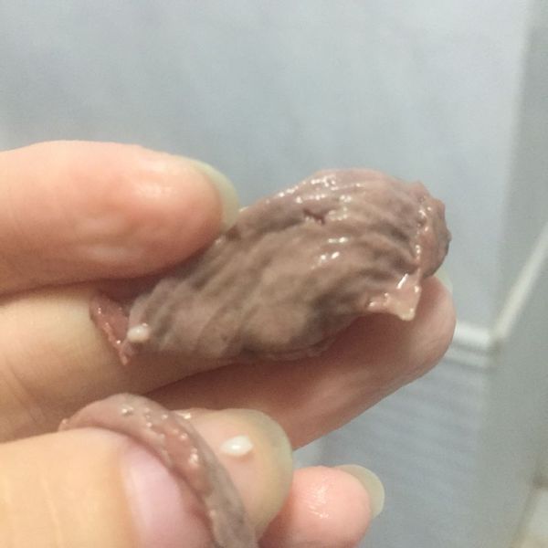 刚才用阴道冲洗器 里面洗出好多像肉皮一样的东西,肉红色的.