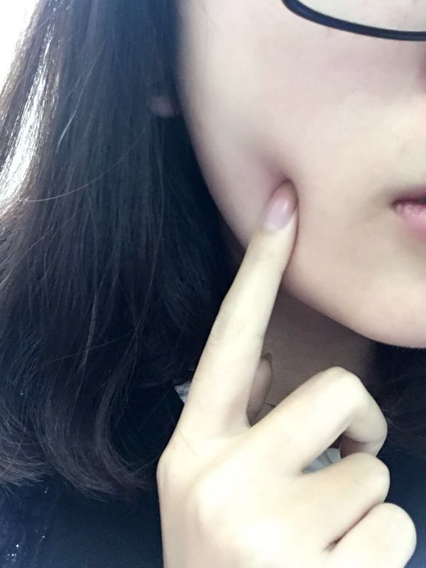 下巴和脸颊之间的皮肤里长了一个小硬块,可以在推动