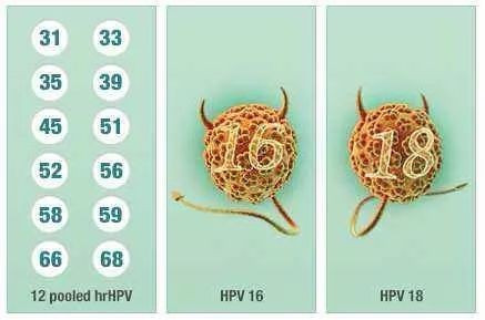 hpv43和hpv56同時都有是什麼意思