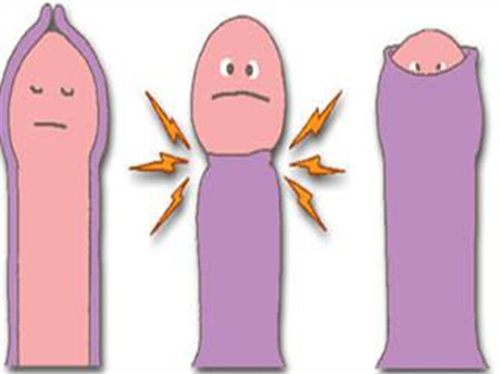 什么是包茎过长