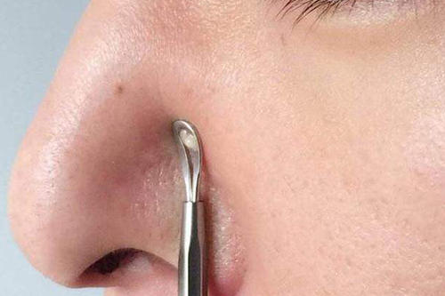 鼻子两侧挤出来的白色东西很难闻,是什么呢?